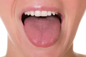 Dil Taşlaması Nedir?