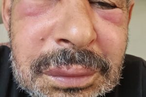 Doktorlarımıza Çağrımızdır: Sağlık İçin Daha Dikkatli ve Bilgilendirici Olalım