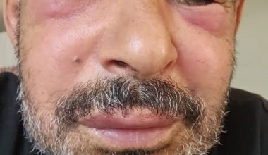 Doktorlarımıza Çağrımızdır: Sağlık İçin Daha Dikkatli ve Bilgilendirici Olalım