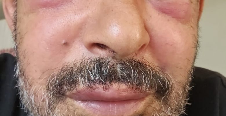 Doktorlarımıza Çağrımızdır: Sağlık İçin Daha Dikkatli ve Bilgilendirici Olalım